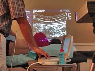 transversus ultrasound