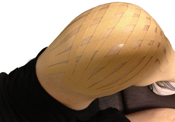 knee pain and swelling kinesiotape